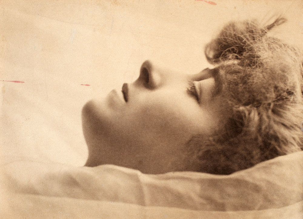 Sepia photograph of a woman's face in profile while she is laying down.